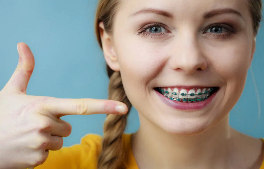 Braces for Kids vs Adults: Is There A Difference?