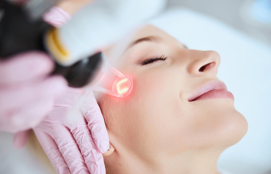 Pico Laser for acne scar treatment