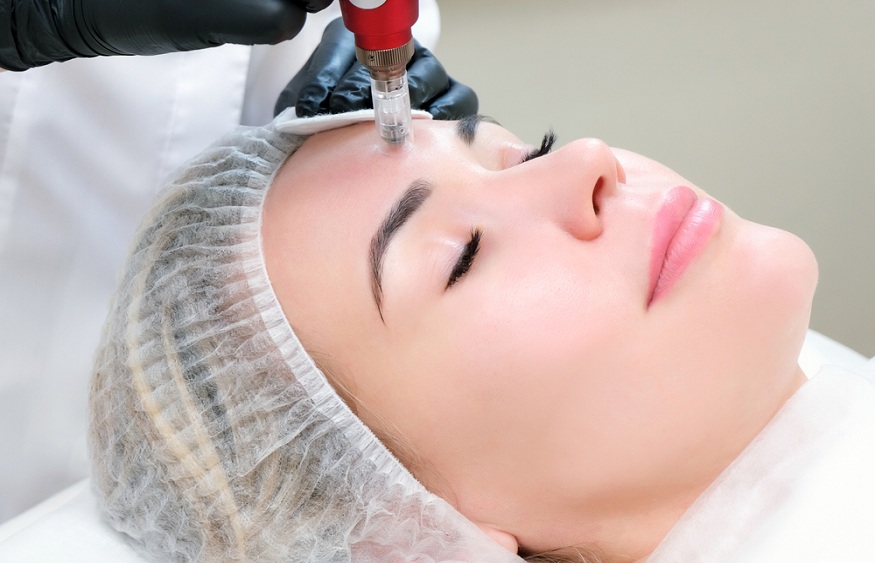 What to Avoid During Microneedling