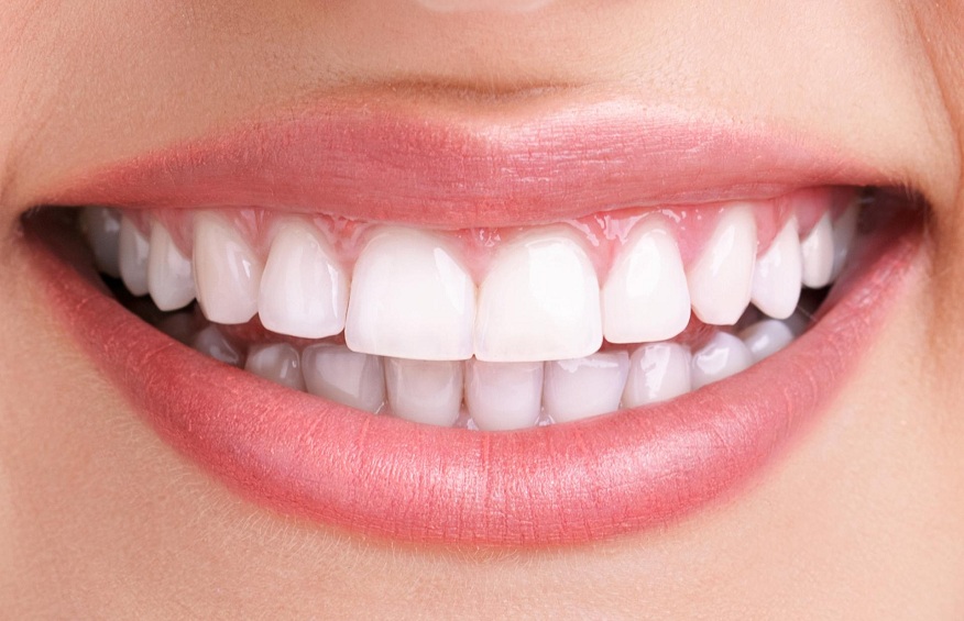 Unlocking Radiant Smiles: Expert Teeth Whitening Advice in Bangkok