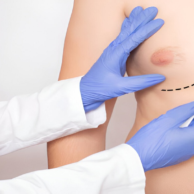 best plastic surgeon in Coimbatore