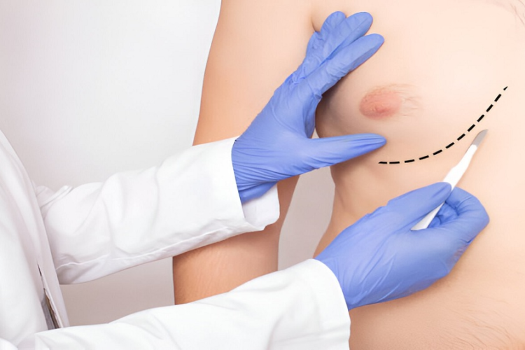 best plastic surgeon in Coimbatore
