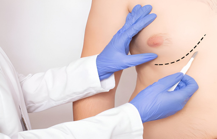 best plastic surgeon in Coimbatore